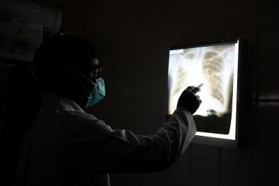 chest x-ray