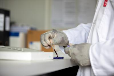 HIV testing